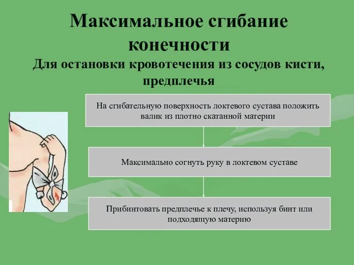 Максимальное сгибание конечности Для остановки кровотечения из сосудов кисти, предплечья На