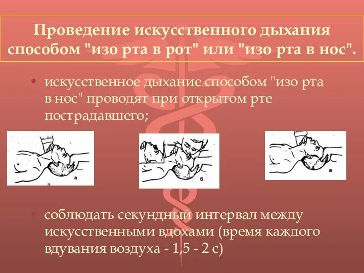 Проведение искусственного дыхания способом "изо рта в рот" или "изо рта