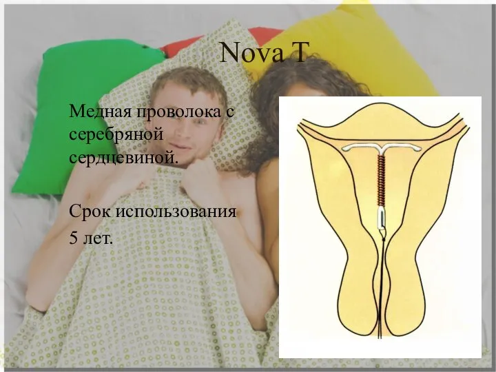 Nova T Медная проволока с серебряной сердцевиной. Срок использования 5 лет.