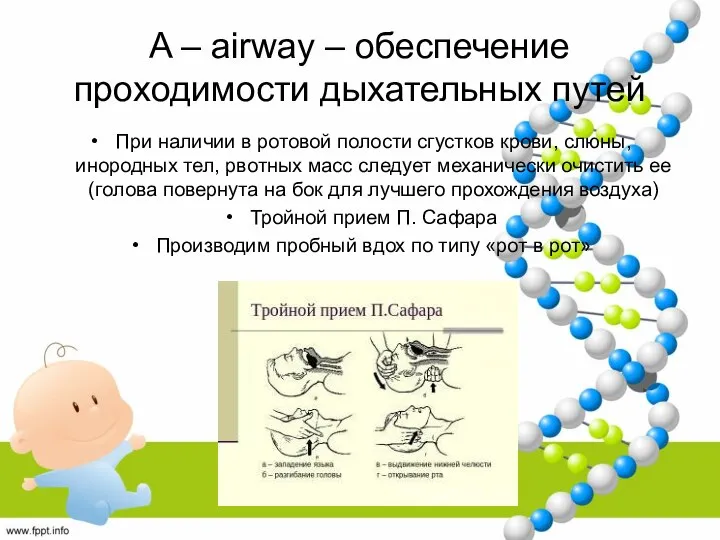 A – airway – обеспечение проходимости дыхательных путей При наличии в