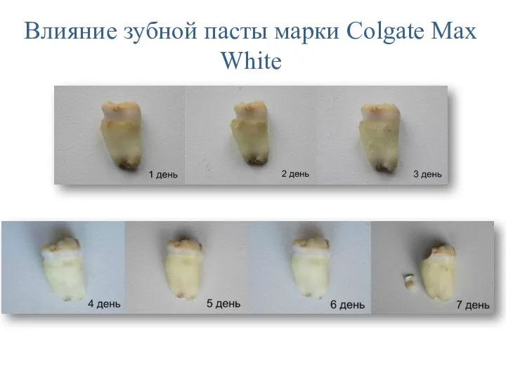 Влияние зубной пасты марки Colgate Max White