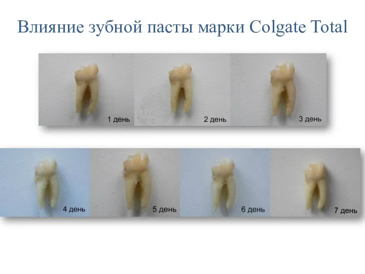 Влияние зубной пасты марки Colgate Total