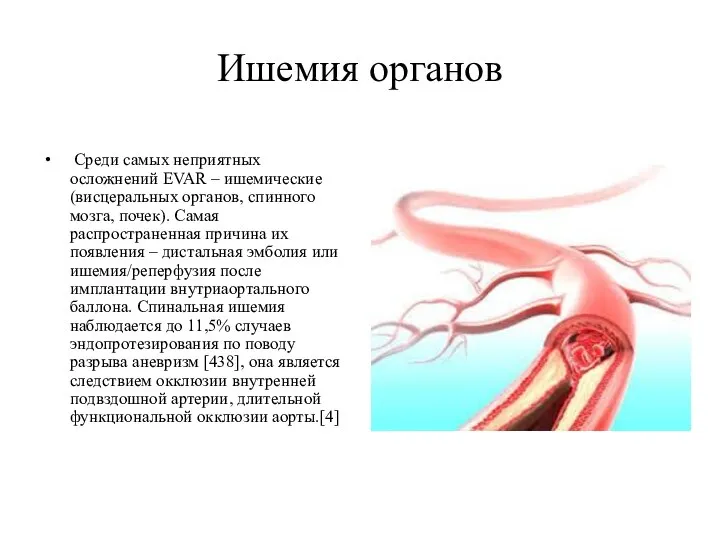 Ишемия органов Среди самых неприятных осложнений EVAR – ишемические (висцеральных органов,