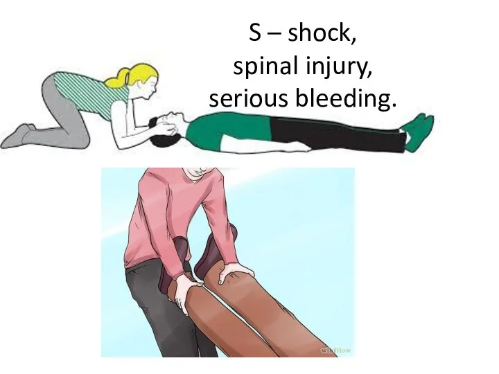 S – shock, spinal injury, serious bleeding.