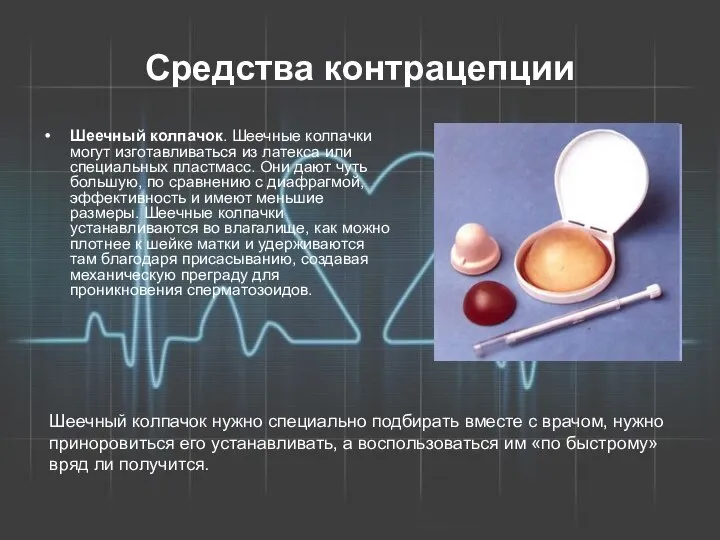 Средства контрацепции Шеечный колпачок. Шеечные колпачки могут изготавливаться из латекса или