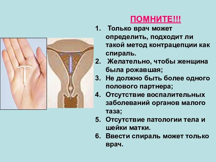 ПОМНИТЕ!!! Только врач может определить, подходит ли такой метод контрацепции как