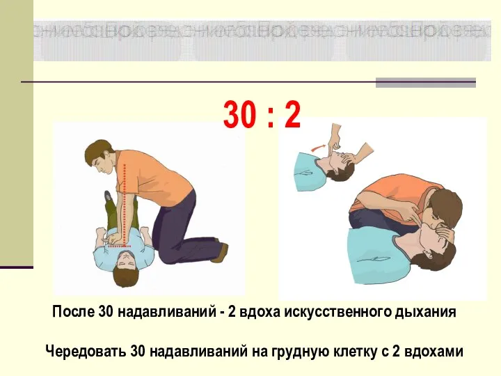 После 30 надавливаний - 2 вдоха искусственного дыхания Чередовать 30 надавливаний