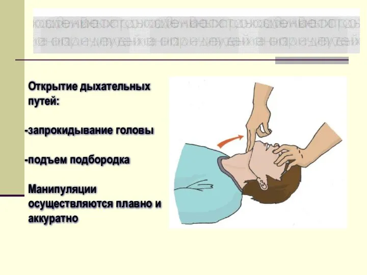 Открытие дыхательных путей: запрокидывание головы подъем подбородка Манипуляции осуществляются плавно и аккуратно