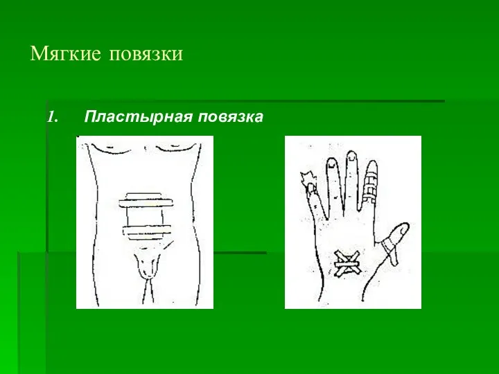 Мягкие повязки Пластырная повязка