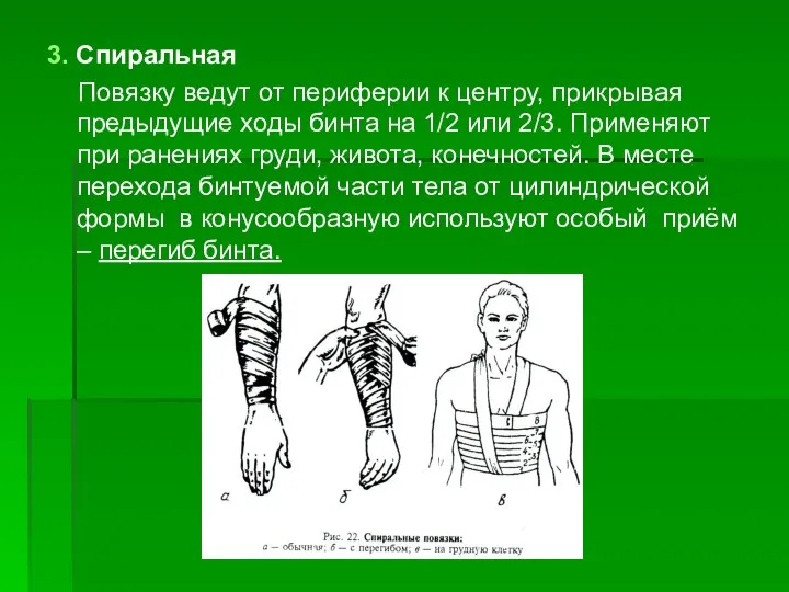 3. Спиральная Повязку ведут от периферии к центру, прикрывая предыдущие ходы