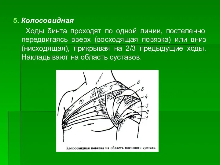 5. Колосовидная Ходы бинта проходят по одной линии, постепенно передвигаясь вверх