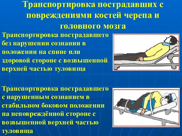 Транспортировка пострадавших с повреждениями костей черепа и головного мозга Транспортировка пострадавшего