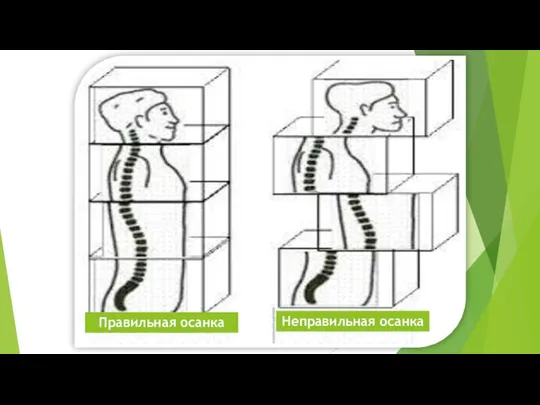 Правильная осанка Неправильная осанка