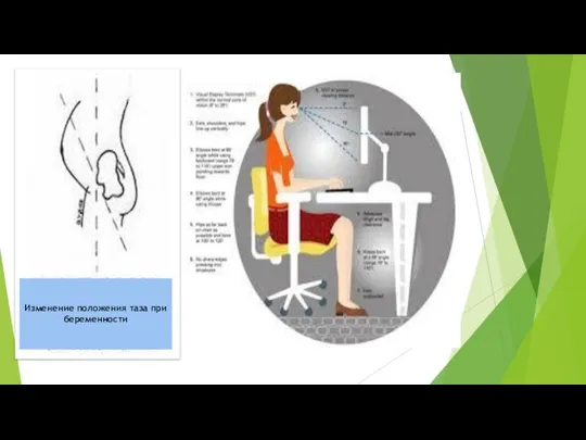 Изменение положения таза при беременности