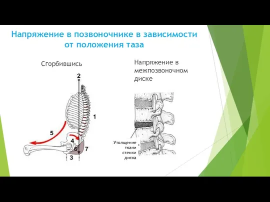 Напряжение в позвоночнике в зависимости от положения таза Сгорбившись Напряжение в