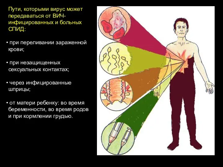 Пути, которыми вирус может передаваться от ВИЧ-инфицированных и больных СПИД: при