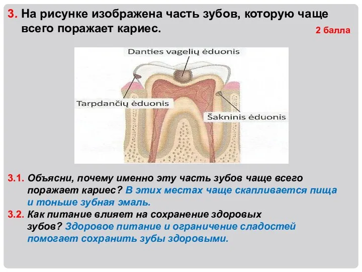 3. На рисунке изображена часть зубов, которую чаще всего поражает кариес.