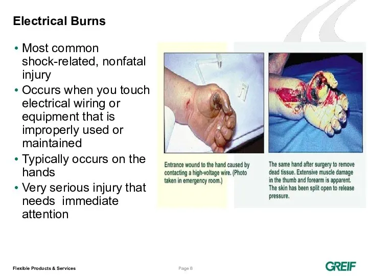 Electrical Burns Most common shock-related, nonfatal injury Occurs when you touch