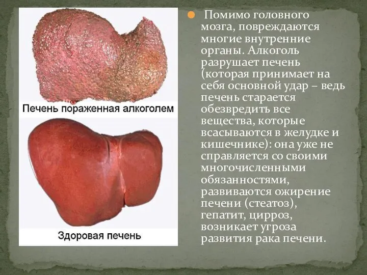 Помимо головного мозга, повреждаются многие внутренние органы. Алкоголь разрушает печень (которая