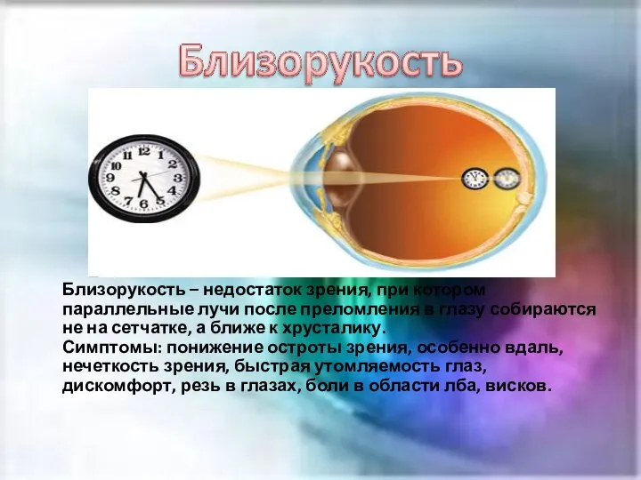 Близорукость – недостаток зрения, при котором параллельные лучи после преломления в