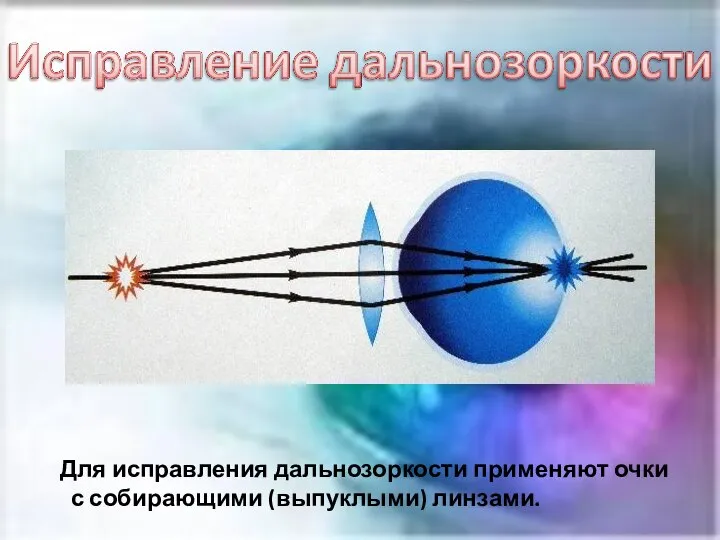 Для исправления дальнозоркости применяют очки с собирающими (выпуклыми) линзами.