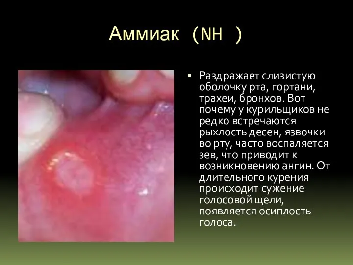 Аммиак (NH ) Раздражает слизистую оболочку рта, гортани, трахеи, бронхов. Вот