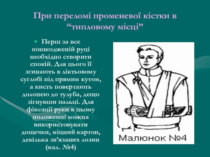 При переломі променевої кістки в “типловому місці” Перш за все пошкодженій