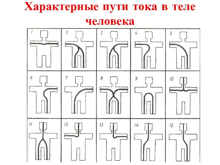 Характерные пути тока в теле человека