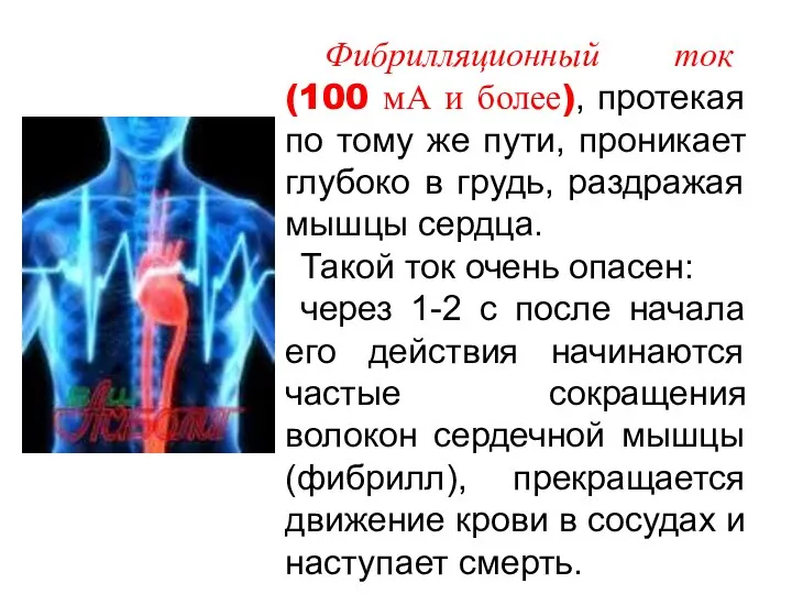 Фибрилляционный ток (100 мА и более), протекая по тому же пути,