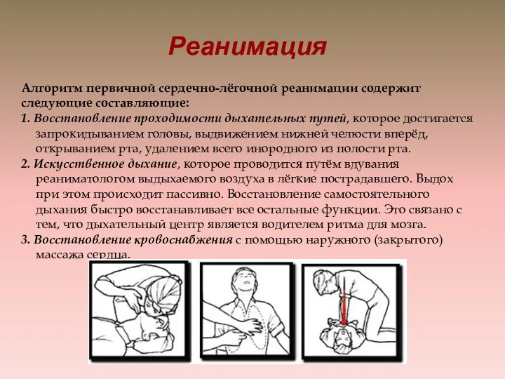 Реанимация Алгоритм первичной сердечно-лёгочной реанимации содержит следующие составляющие: 1. Восстановление проходимости