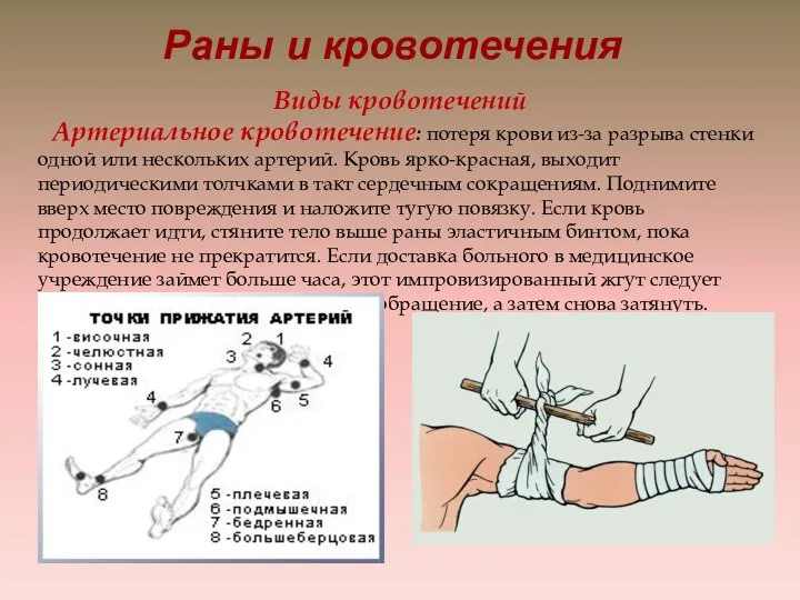 Раны и кровотечения Виды кровотечений Артериальное кровотечение: потеря крови из-за разрыва