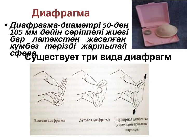 Диафрагма Диафрагма-диаметрі 50-ден 105 мм дейін серіппелі жиегі бар латекстен жасалған