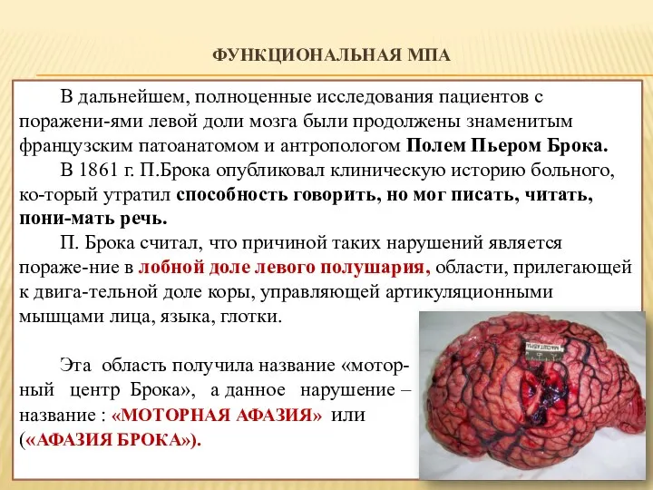 ФУНКЦИОНАЛЬНАЯ МПА В дальнейшем, полноценные исследования пациентов с поражени-ями левой доли