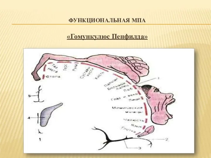 ФУНКЦИОНАЛЬНАЯ МПА «Гомункулюс Пенфилда»