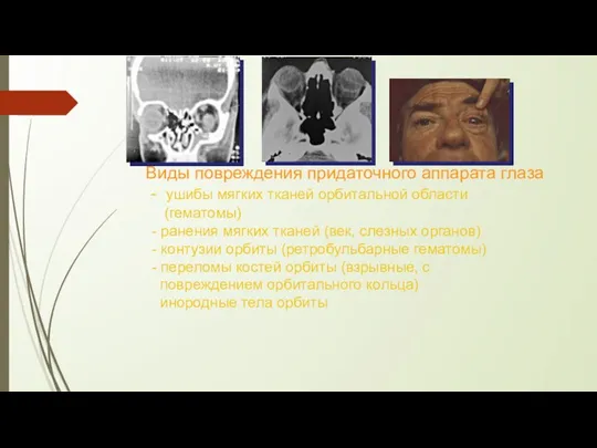 Виды повреждения придаточного аппарата глаза - ушибы мягких тканей орбитальной области