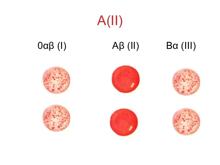 A(II) 0αβ (I) Аβ (II) Вα (III)