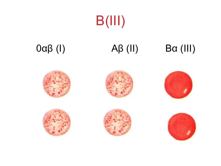 B(III) 0αβ (I) Аβ (II) Вα (III)