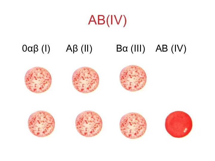 AB(IV) 0αβ (I) Аβ (II) Вα (III) АВ (IV)