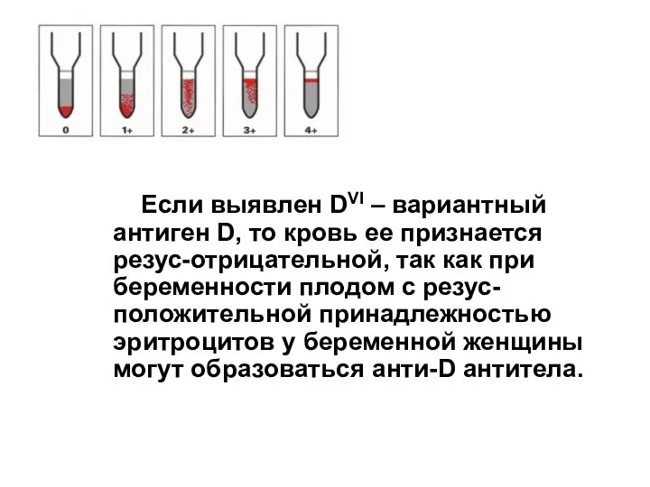 Если выявлен DVI – вариантный антиген D, то кровь ее признается