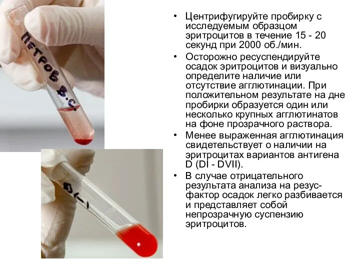 Центрифугируйте пробирку с исследуемым образцом эритроцитов в течение 15 - 20