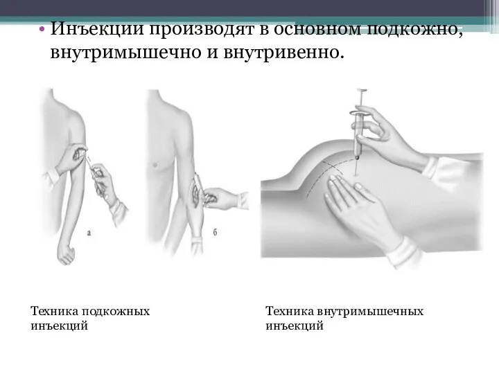 Инъекции производят в основном подкожно, внутримышечно и внутривенно. Техника подкожных инъекций Техника внутримышечных инъекций