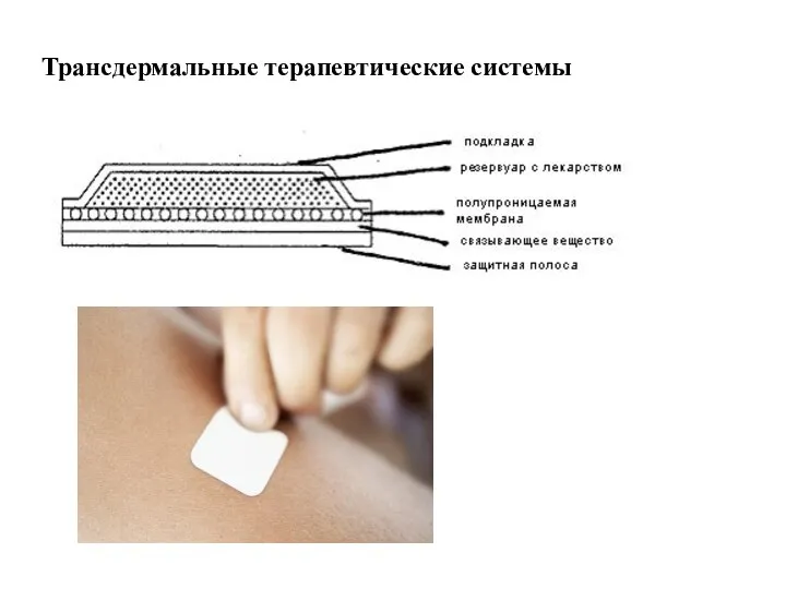 Трансдермальные терапевтические системы