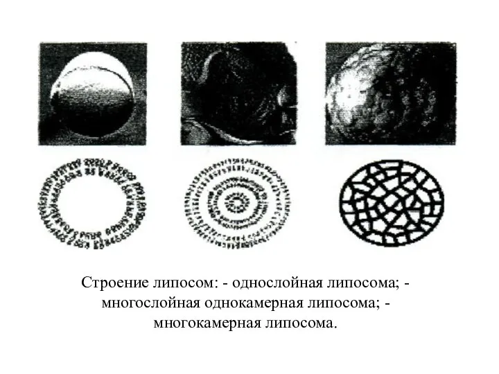 Строение липосом: - однослойная липосома; - многослойная однокамерная липосома; - многокамерная липосома.