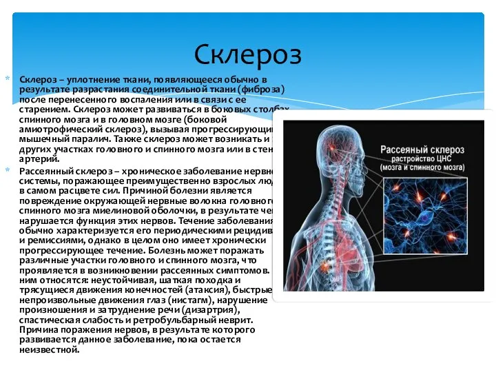 Склероз – уплотнение ткани, появляющееся обычно в результате разрастания соединительной ткани