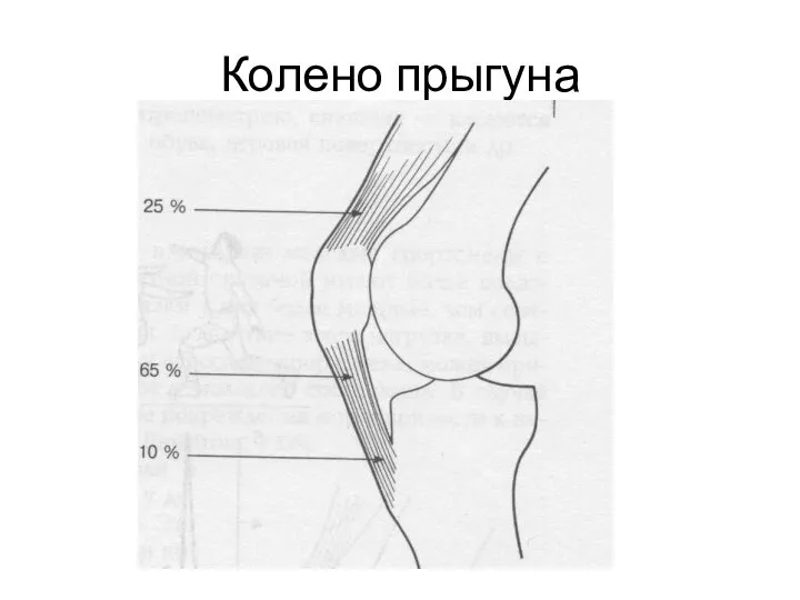 Колено прыгуна