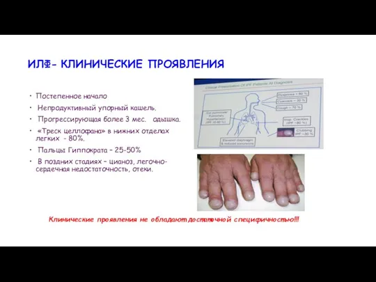 Постепенное начало Непродуктивный упорный кашель. Прогрессирующая более 3 мес. одышка. «Треск