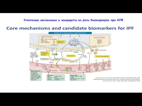 Ключевые механизмы и кандидаты на роль биомаркеров при ИЛФ