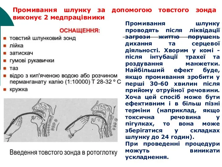 Промивання шлунку за допомогою товстого зонда виконує 2 медпрацівники Промивання шлунку