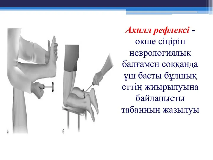 Ахилл рефлексі - өкше сіңірін неврологиялық балғамен соққанда үш басты бұлшық еттің жиырылуына байланысты табанның жазылуы