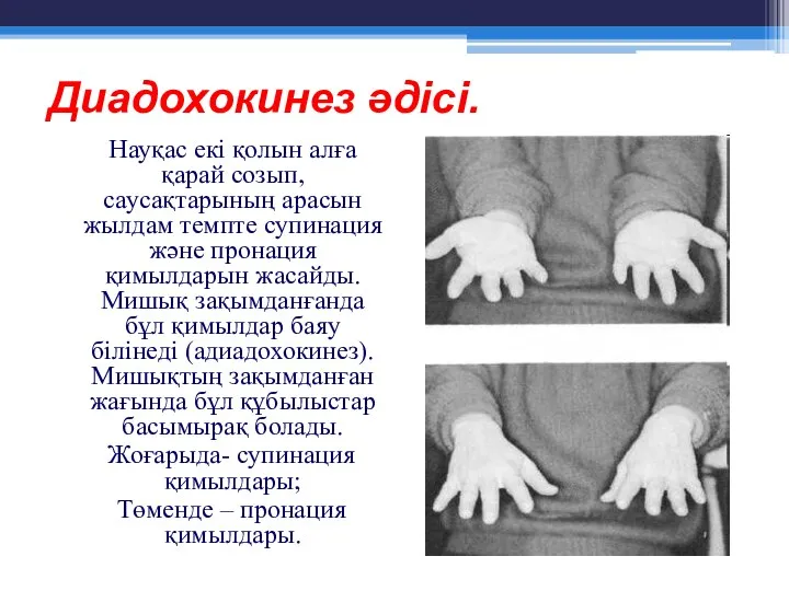 Диадохокинез әдісі. Науқас екі қолын алға қарай созып, саусақтарының арасын жылдам